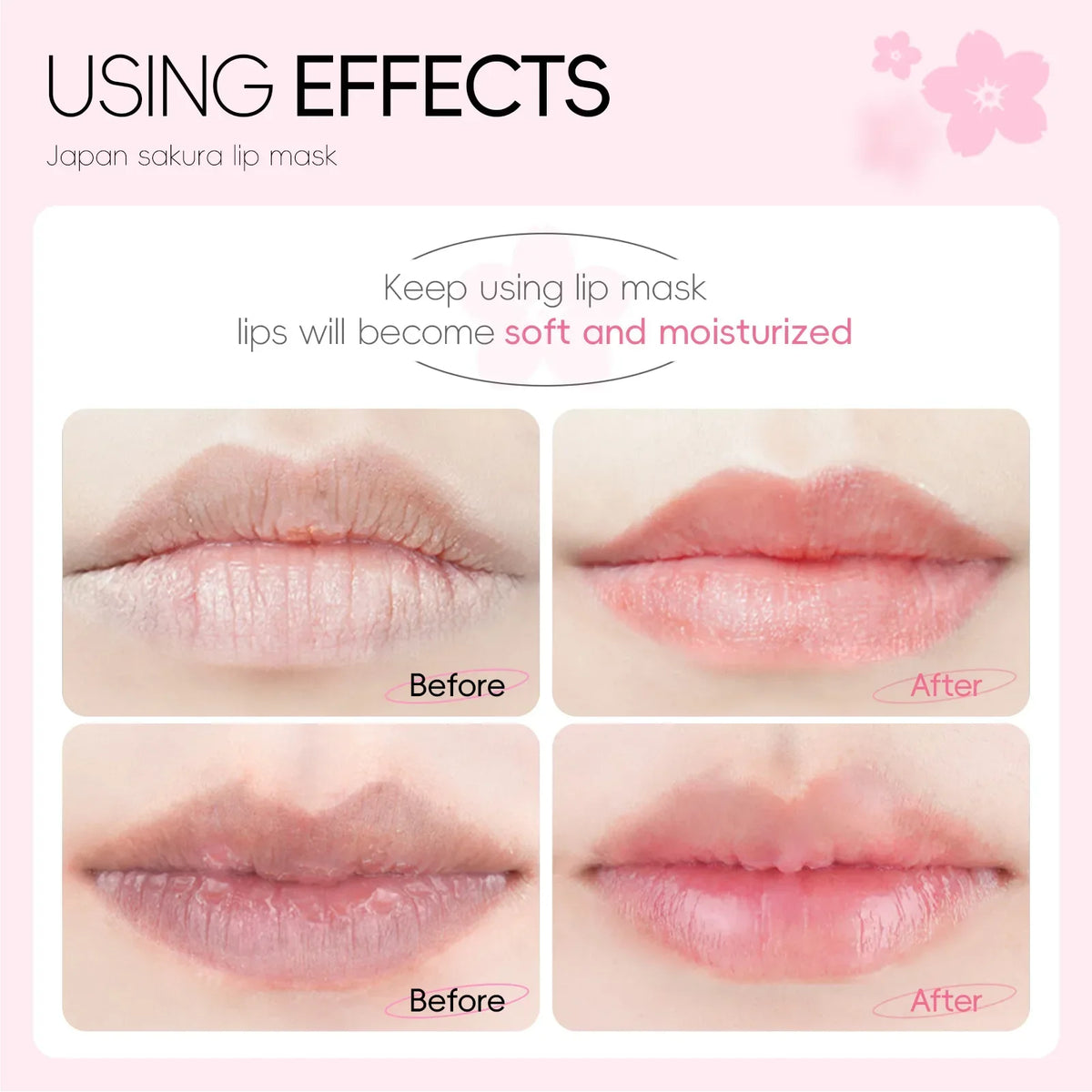 LAIKOU 5 Lip Mask Care Moisturizing Hydrating Repair Lighten Lines