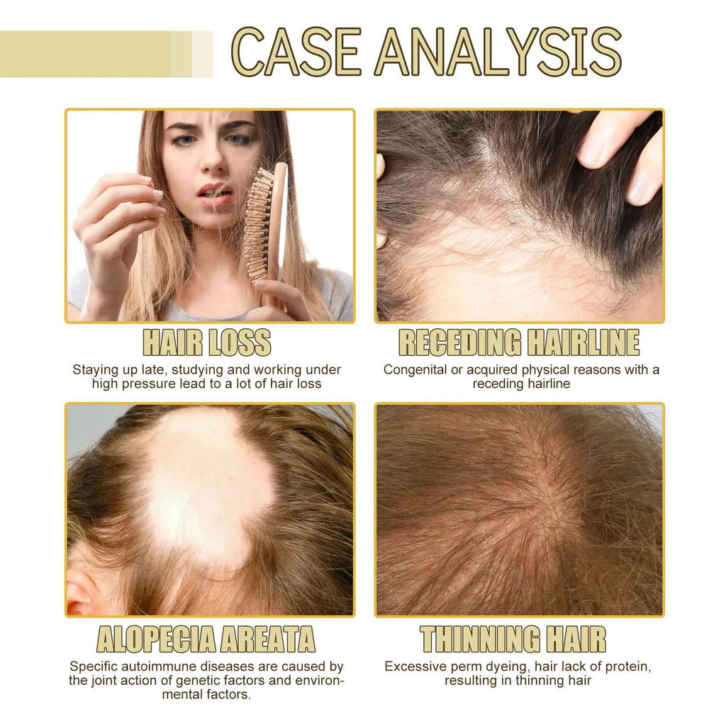 Jaysuing Rosemary Hair Growth Oil – Thicken & Strengthen 60ml
