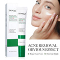 SADOER Salicylic Acid Face Cream | Acne & Blackhead Control
