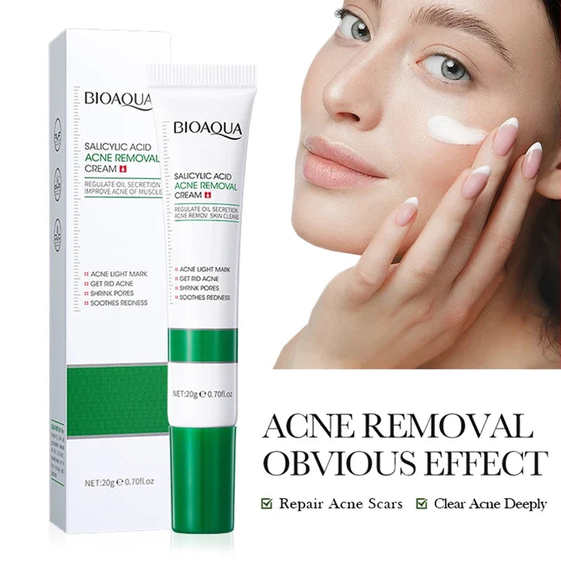 SADOER Salicylic Acid Face Cream | Acne & Blackhead Control