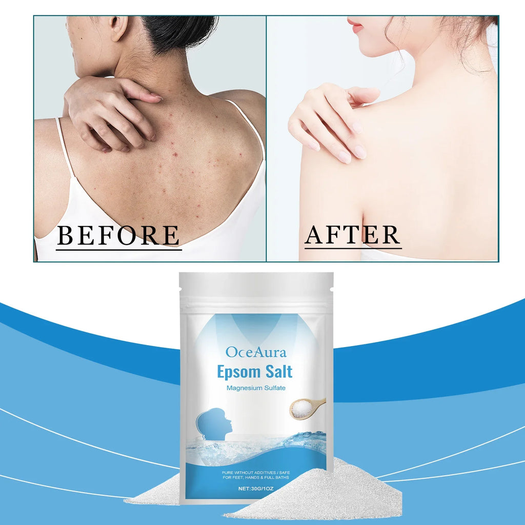 OceAura Epsom Salt Bath Soak – Mineral Exfoliating Bath Crystals
