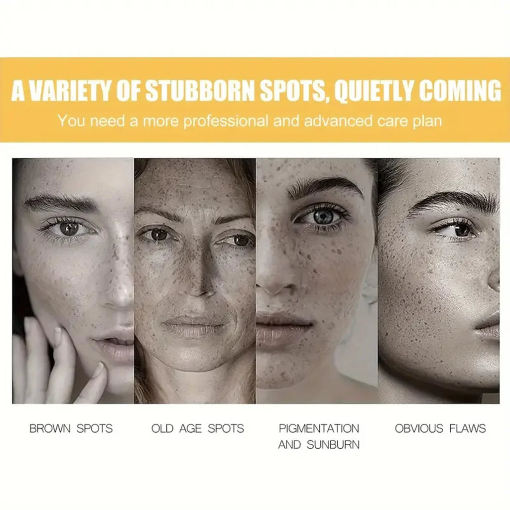 Vitamin C Face Serum – Hyaluronic Acid & Dark Spot Care