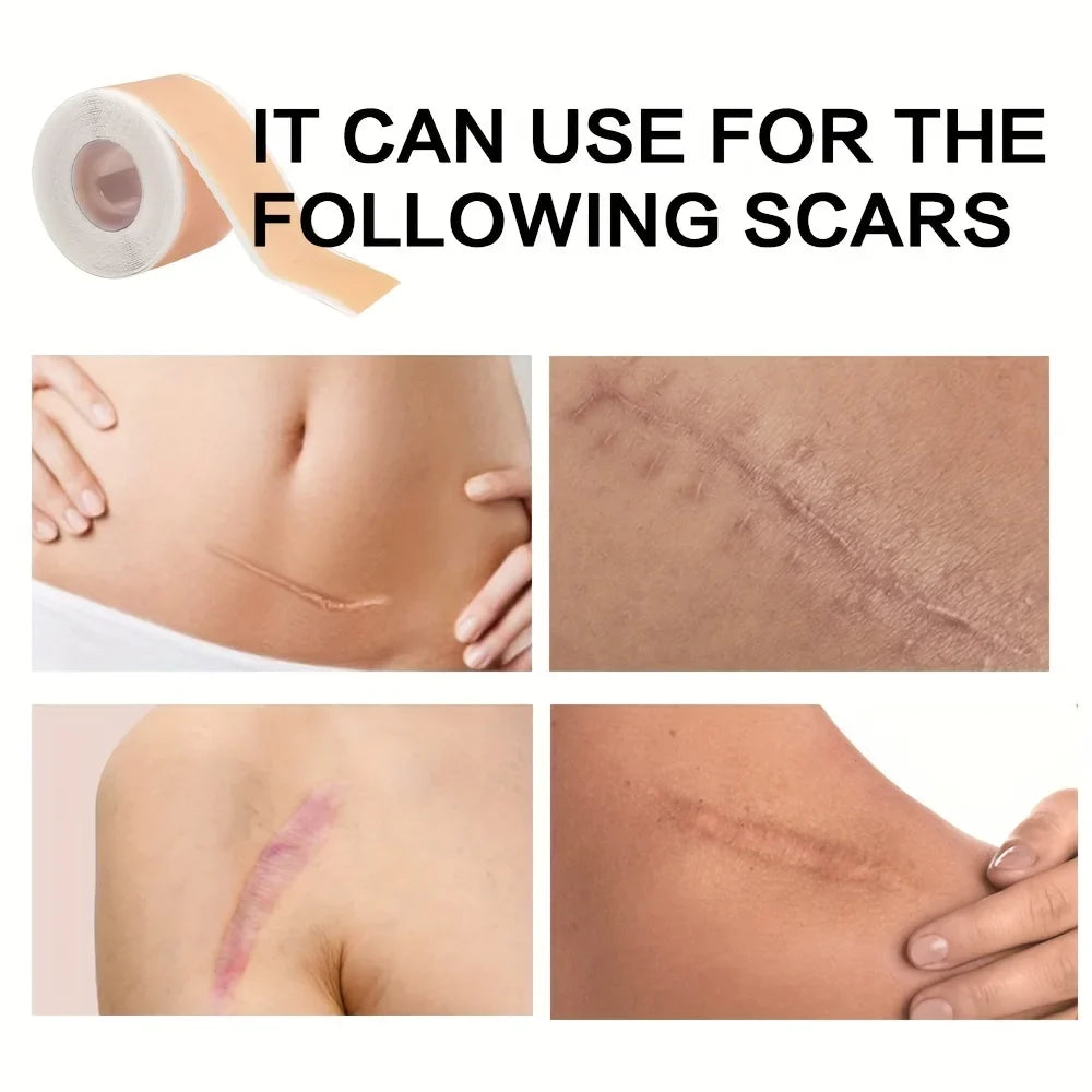 Invisible Silicone Scar Covering Patch 150cm Roll