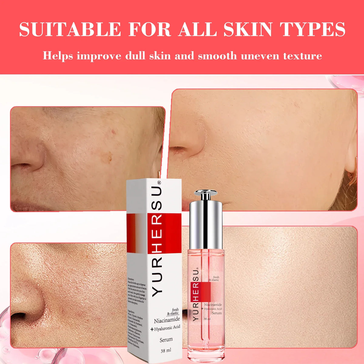 Niacinamide Face Serum – Moisturizing & Translucent Lotion
