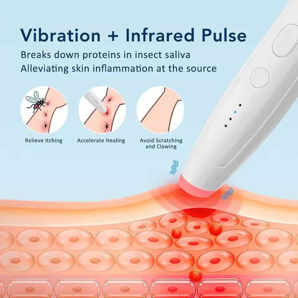 Infrared Pulse Itch Relief Pen | Insect Bite Soother