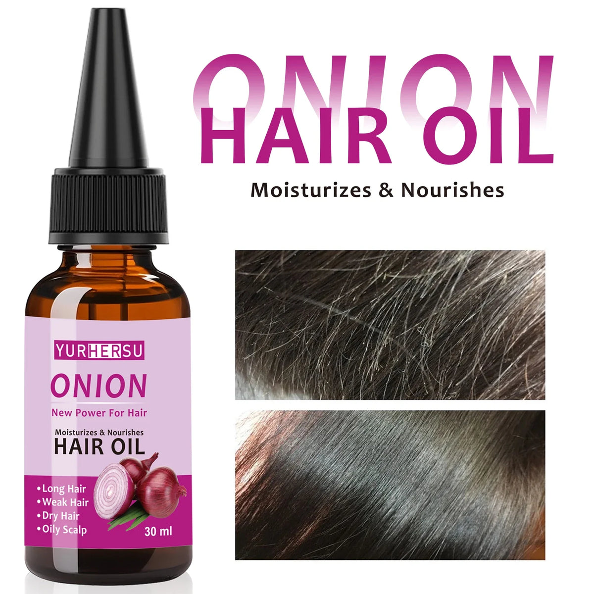 YURHERSU Onion Hair Oil – Pure Natural Hair Growth Treatment