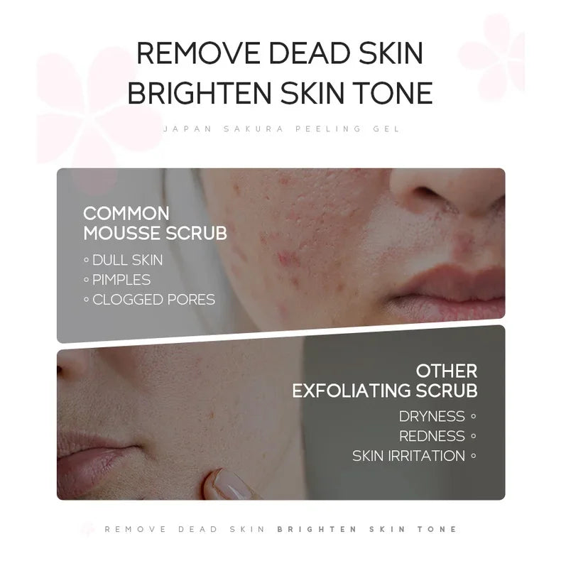 LAIKOU Sakura Peeling Gel – Exfoliate & Cleanse Pores 60g