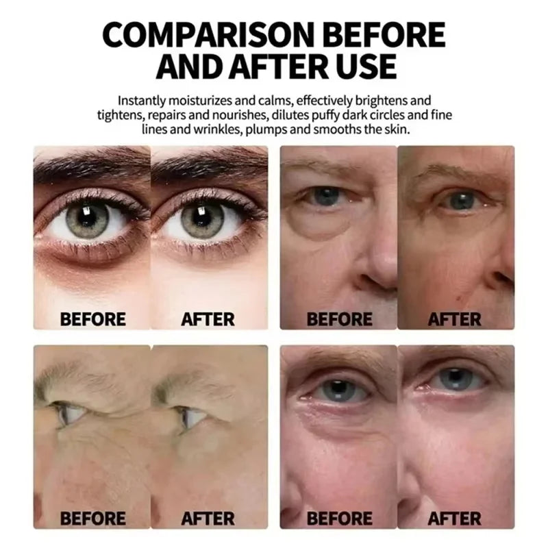 SADOER Collagen Eye Cream – Brighten & Firm Under Eyes