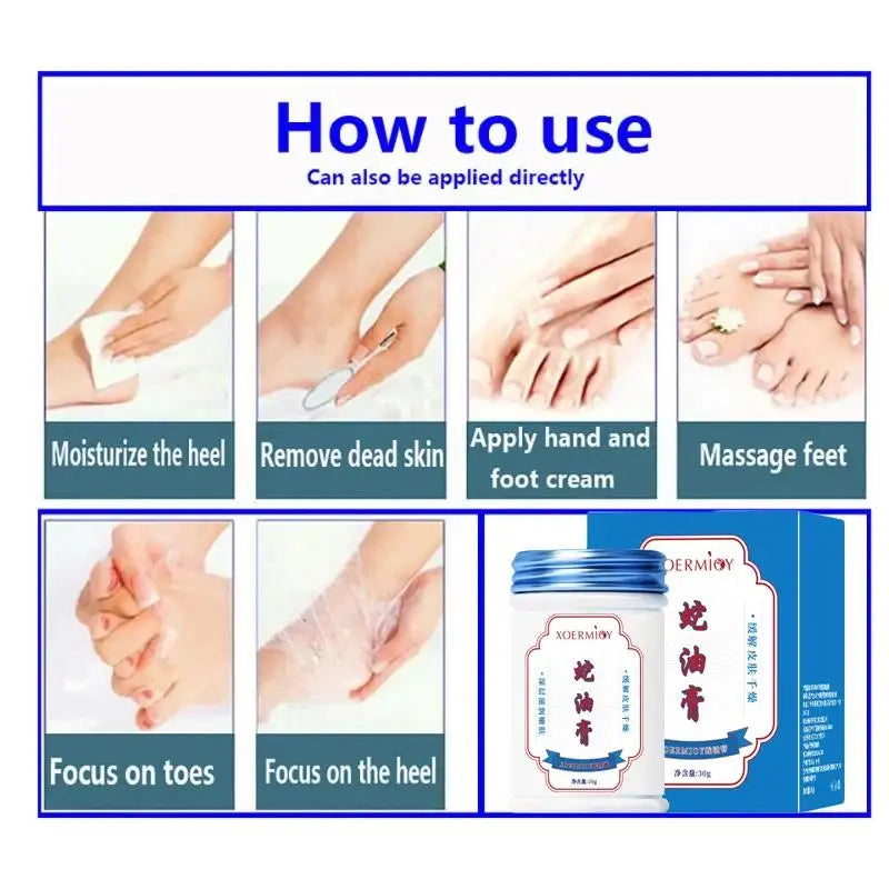 Herbal Anti-Crack Foot Cream – Heel Repair & Moisturizer