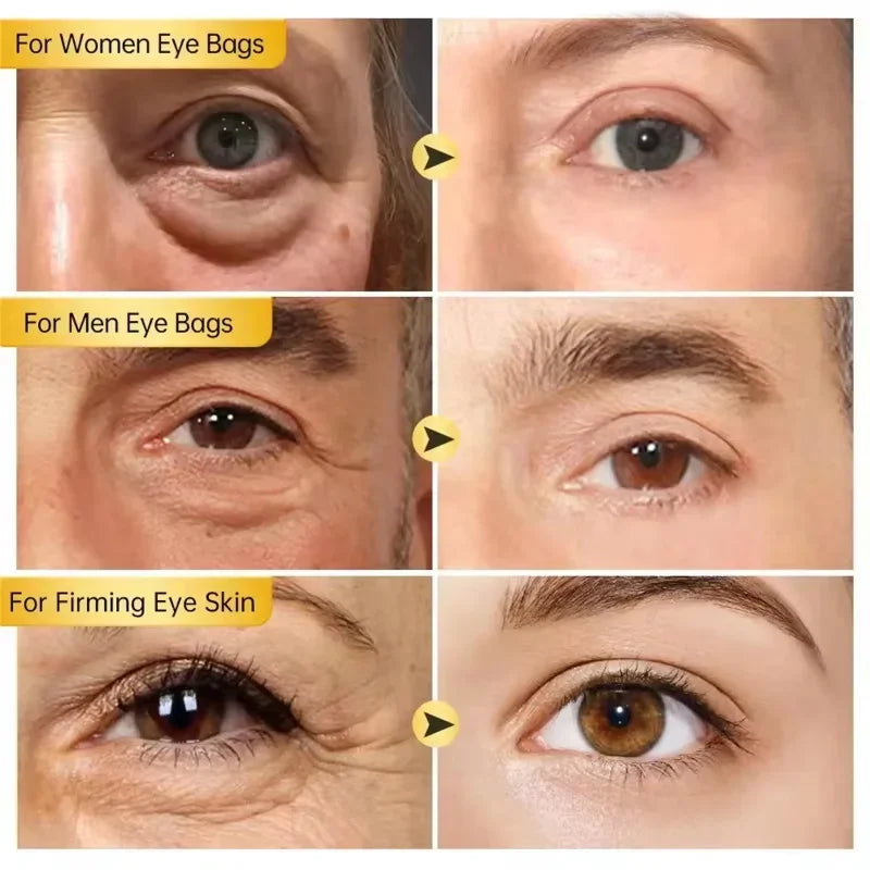 Eelhoe Retinol Eye Cream Stick – Firm, Brighten & Hydrate