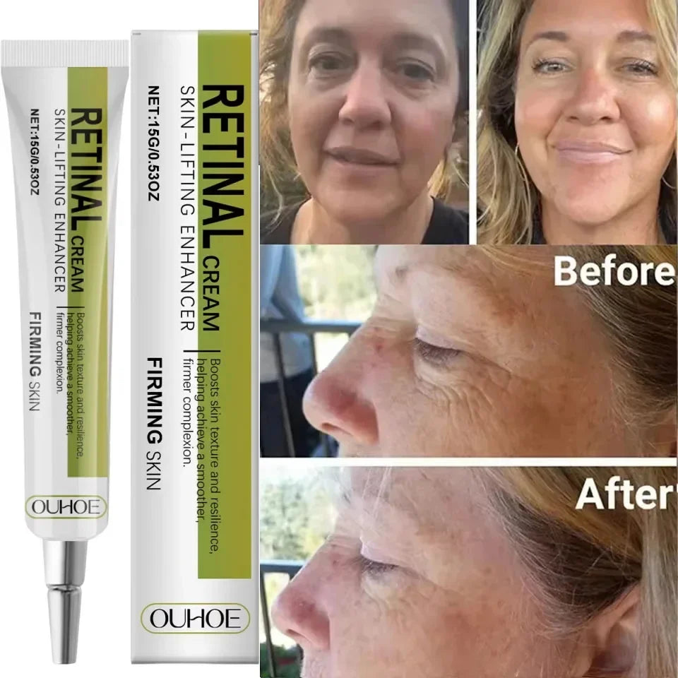Retinol Face Cream – Firming, Anti-Aging & Moisturizing