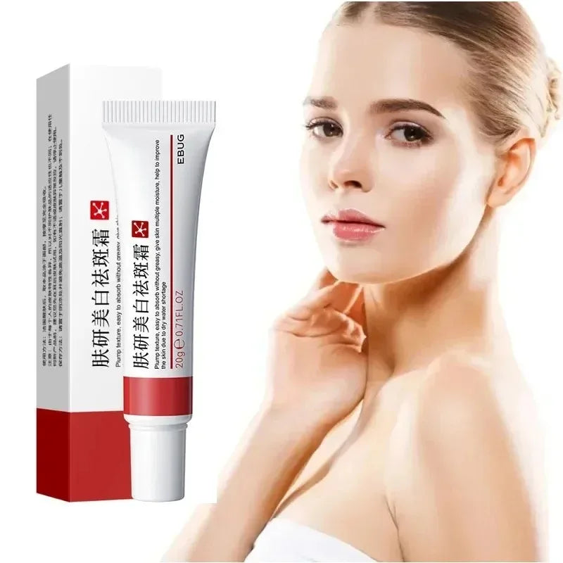 Niacinamide Whitening Freckle Cream | Dark Spot & Melasma