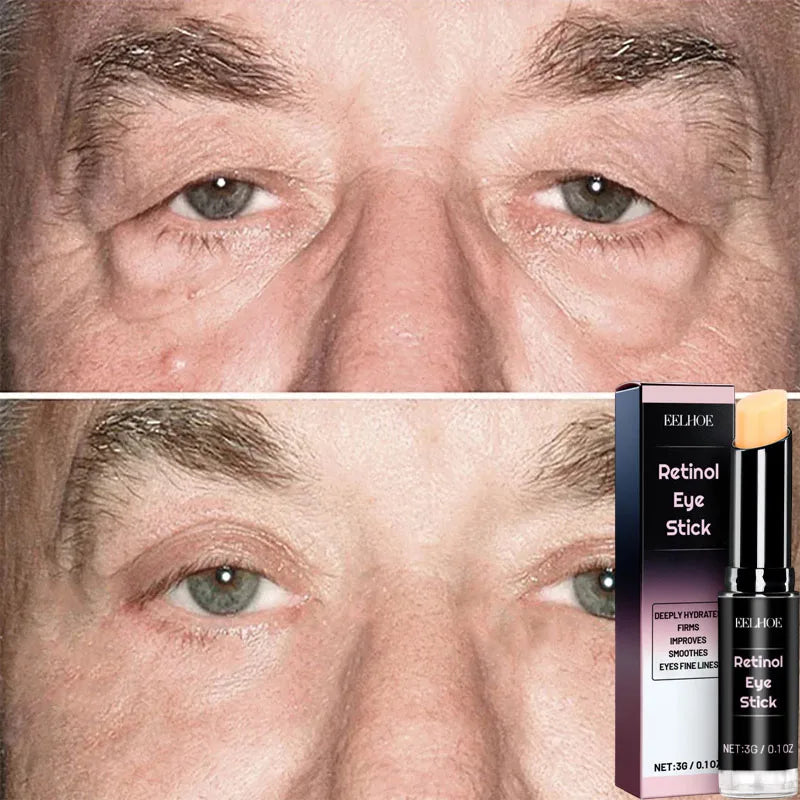 Eelhoe Retinol Eye Cream Stick – Firm, Brighten & Hydrate