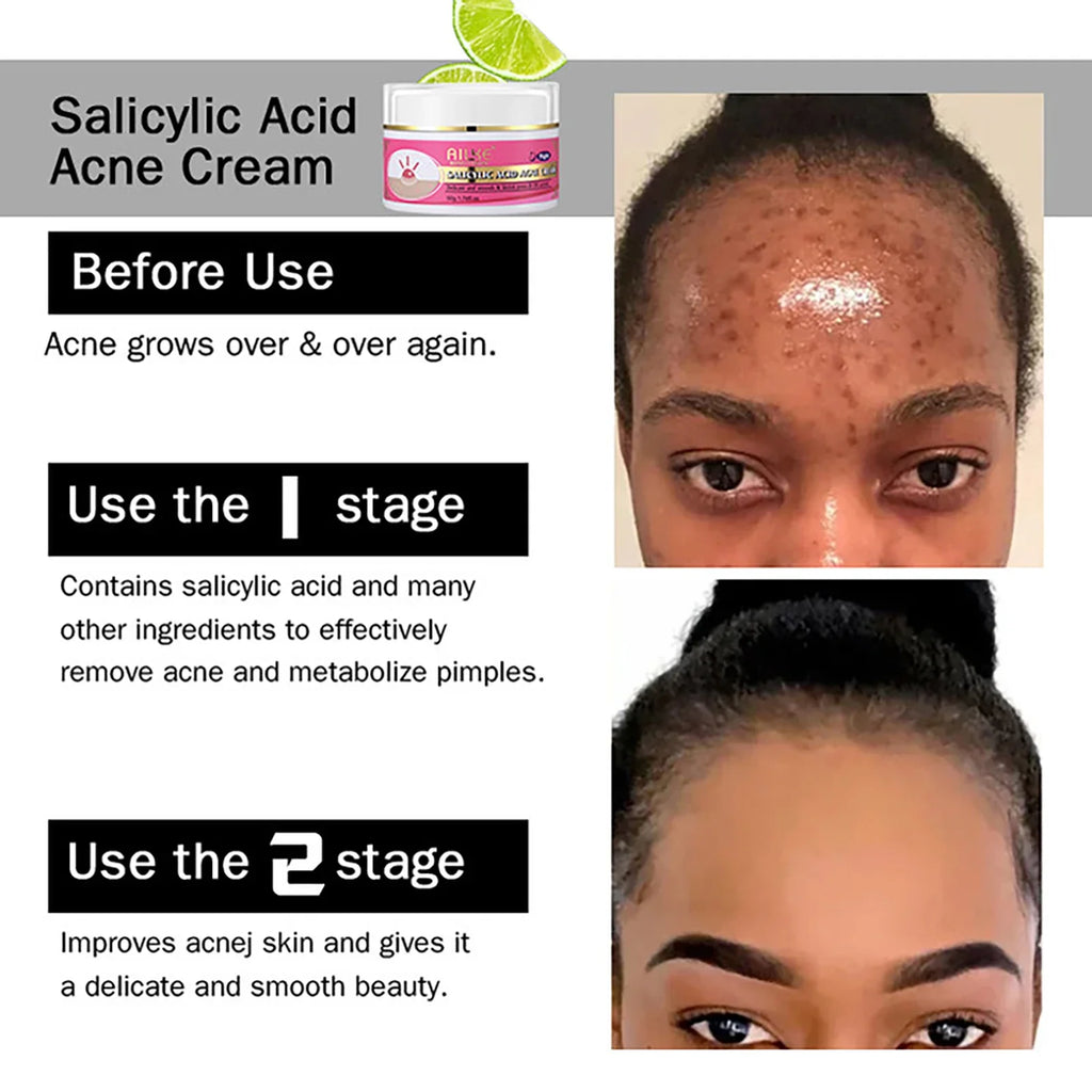 AILKE Brightening Face Cream – Blemish & Dark Spot Cream 50ml