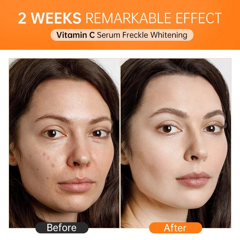 Vitamin C Face Serum – Hyaluronic Acid & Niacinamide 15ml