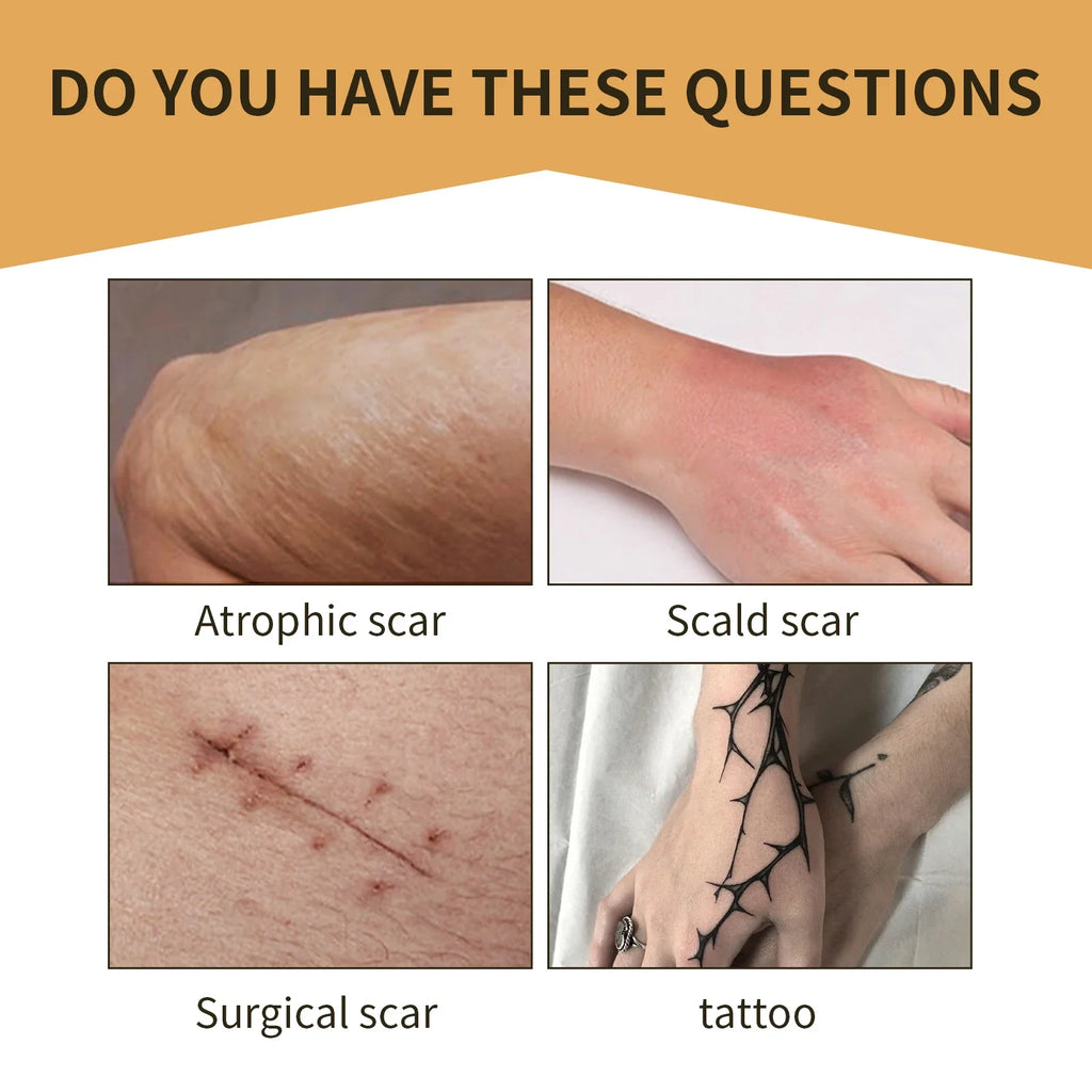 Waterproof Scar & Tattoo Cover Patches – Invisible Body Concealer