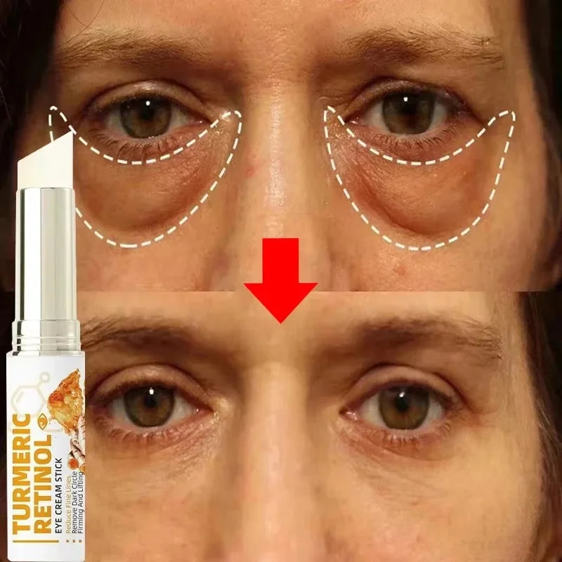SADOER Retinol Eye Cream – Brighten, Firm & Hydrate