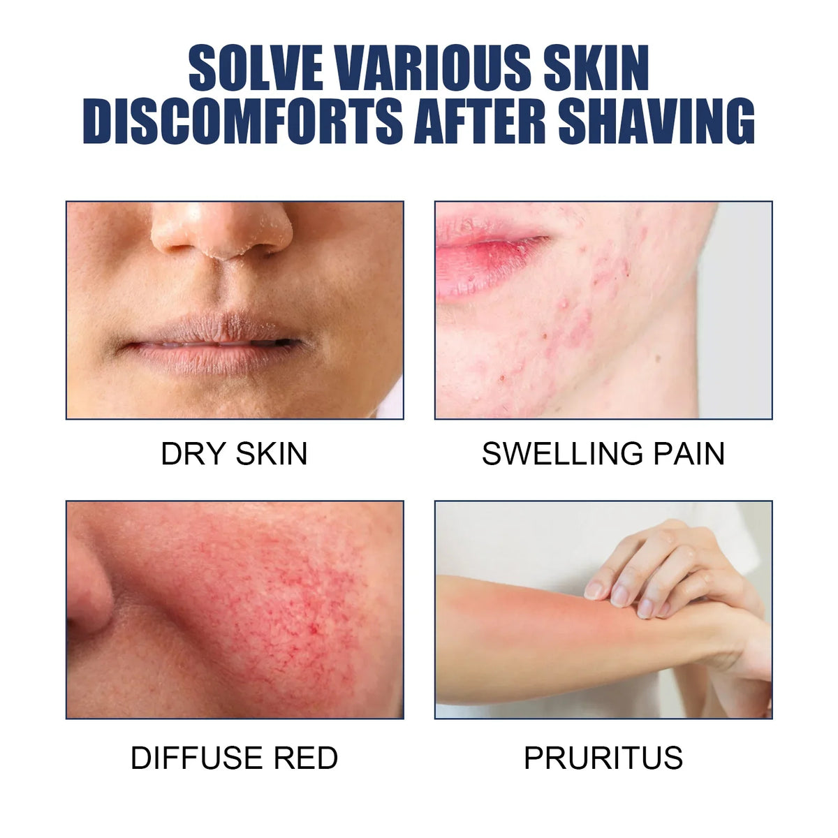 After Shave Serum – Ingrown Hair & Dark Spot Lotion 90ml