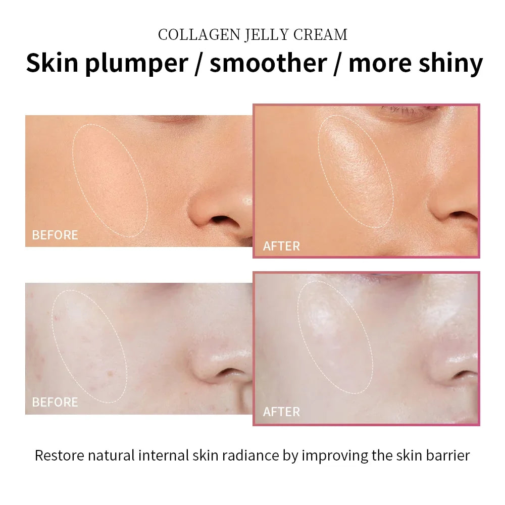 Collagen Jelly Cream with Niacinamide – Hydrating & Firming