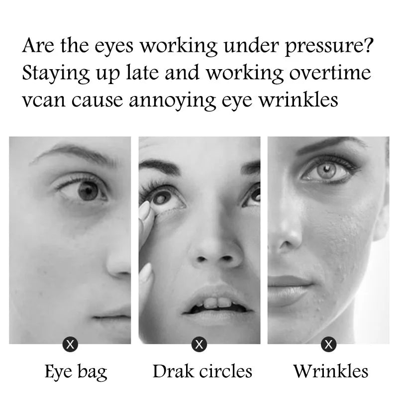 BIOAQUA Golden Caviar Eye Mask – 10 Pairs Hydrating Patches