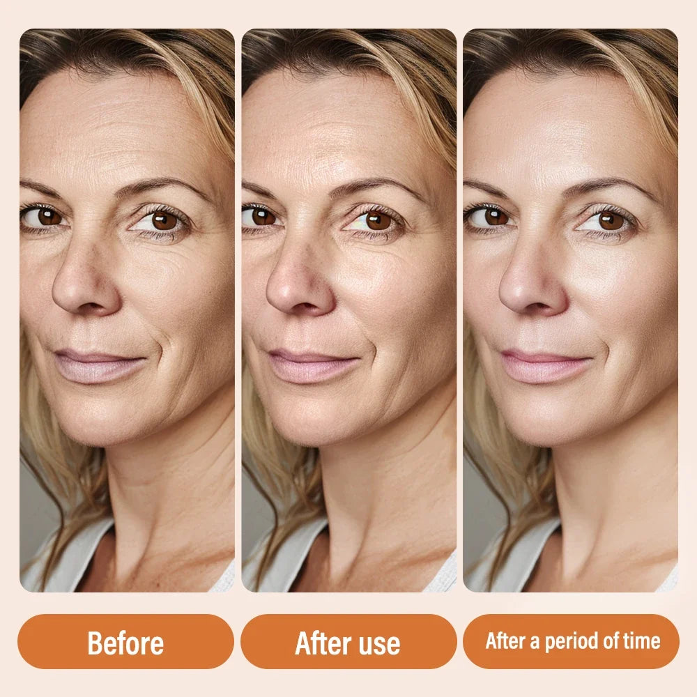 Vitamin C Face Serum – Dark Spot, Hyaluronic Acid & Anti-Aging