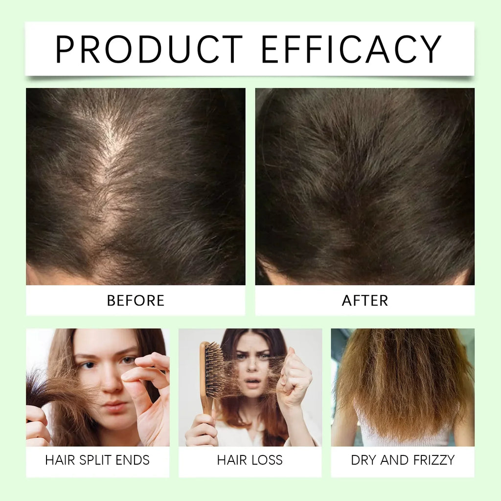 HOEGOA Rosemary Keratin Shampoo – Nourish & Oil Control 100ml