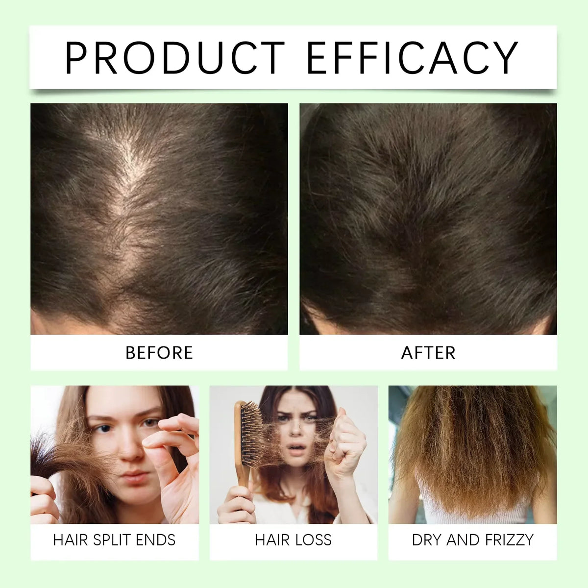 HOEGOA Rosemary Keratin Shampoo – Nourish & Oil Control 100ml