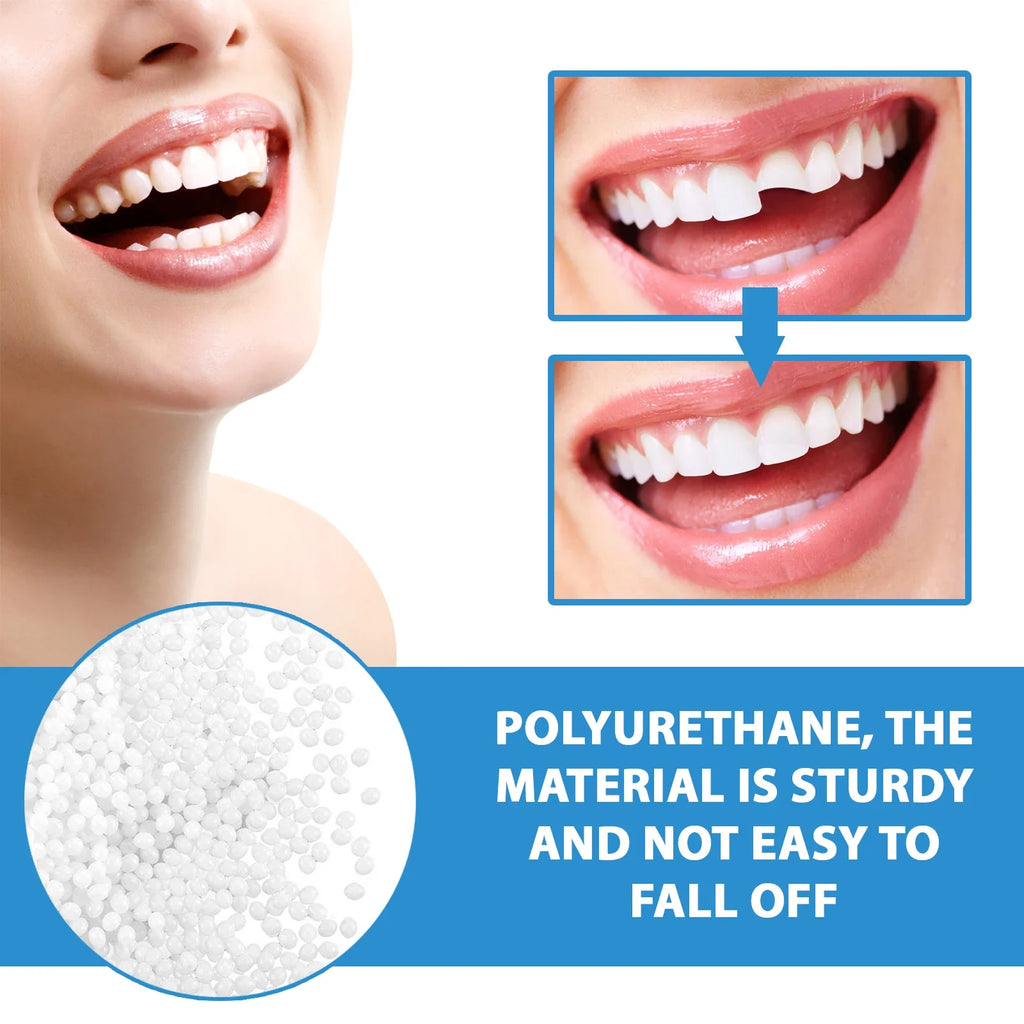 Jaysuing 30g Moldable Temporary Tooth Repair Gel Kit