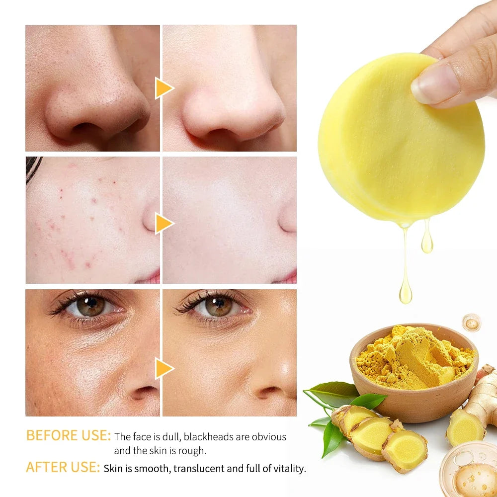 Turmeric & Kojic Acid Exfoliating Cleansing Pads – 80 Pack