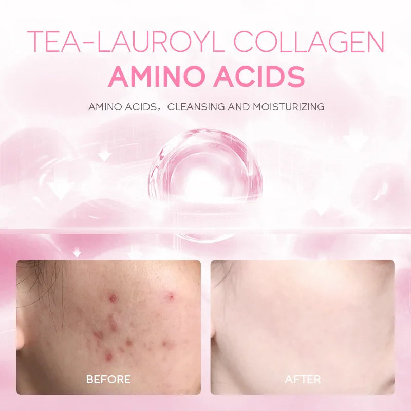 Sakura Foam Facial Cleanser – Brightening, Acne & Oil Control