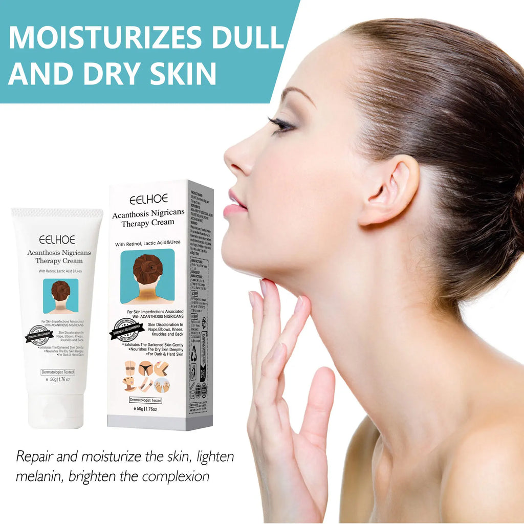EELHOE Skin Brightening Body Cream – Neck, Underarm & Knees