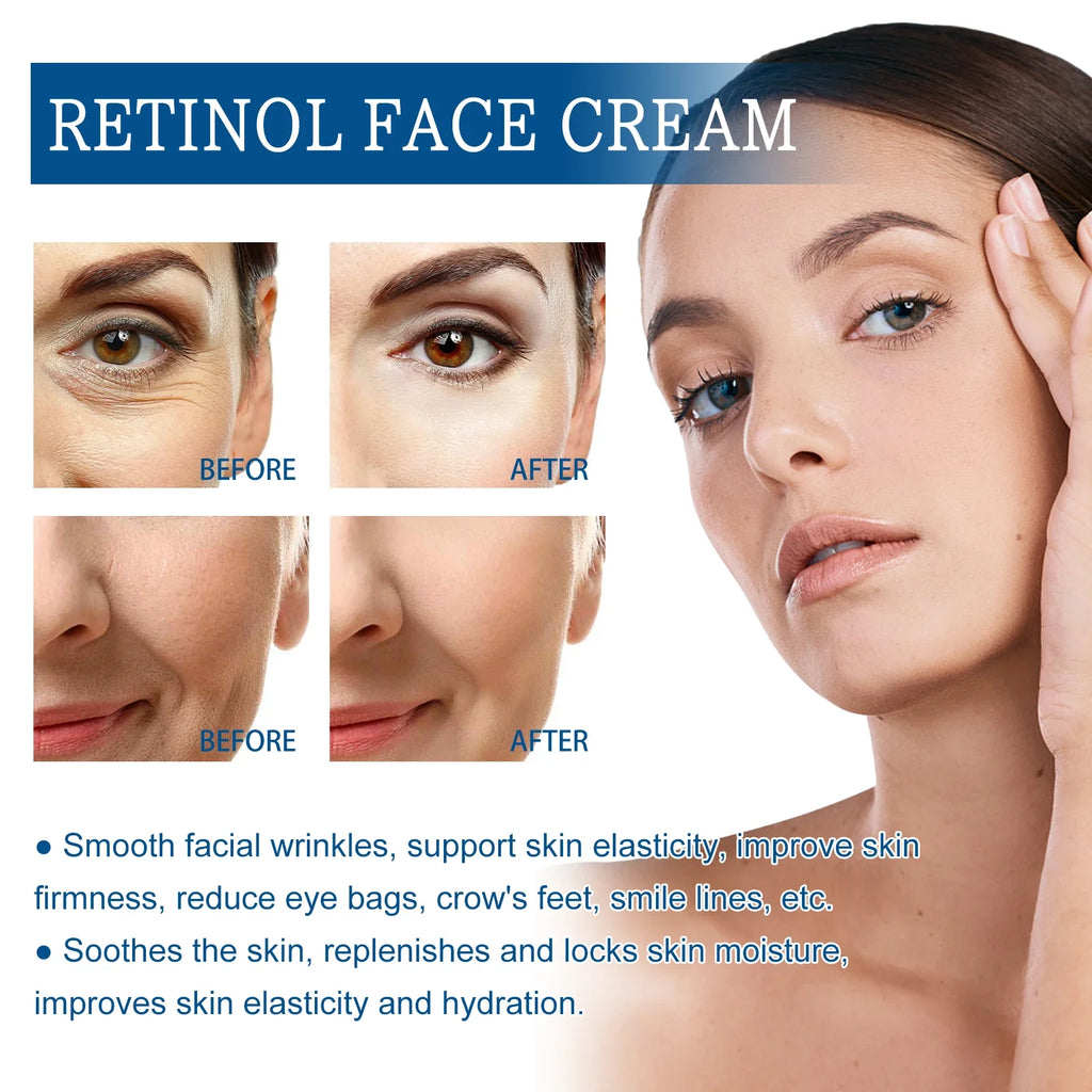 Jaysuing Retinol Anti-Aging Face Cream – Lift, Firm & Smooth