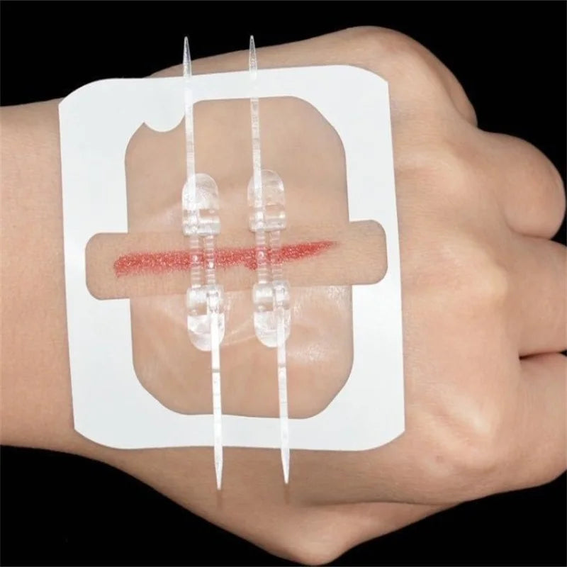 Emergency Wound Closure Zip Stitch Sutures Bandaids Repair Wounds