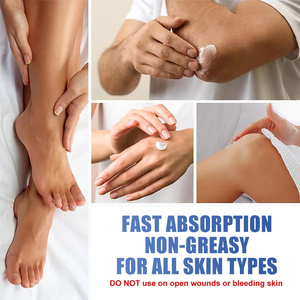 60% Urea Hand & Foot Cream – Salicylic Acid & Glycerin 200g