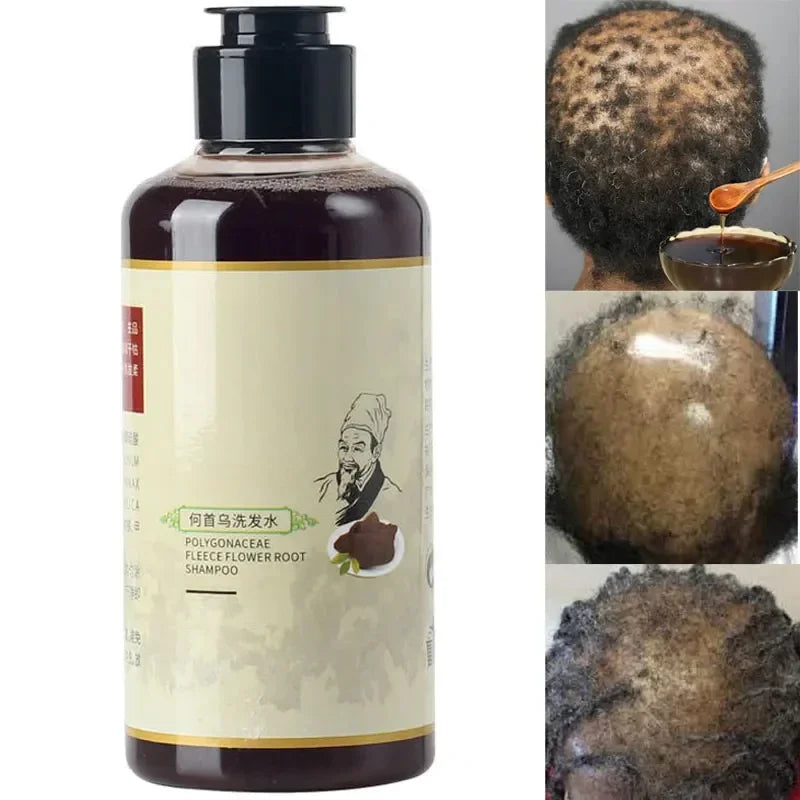 Herbal Hair Growth Shampoo 300ml – Ginseng & Botanical Blend