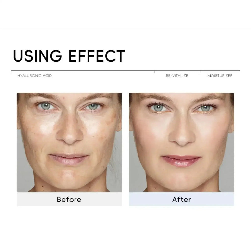 LAIKOU Hyaluronic Acid Face Cream – Hydrating & Brightening