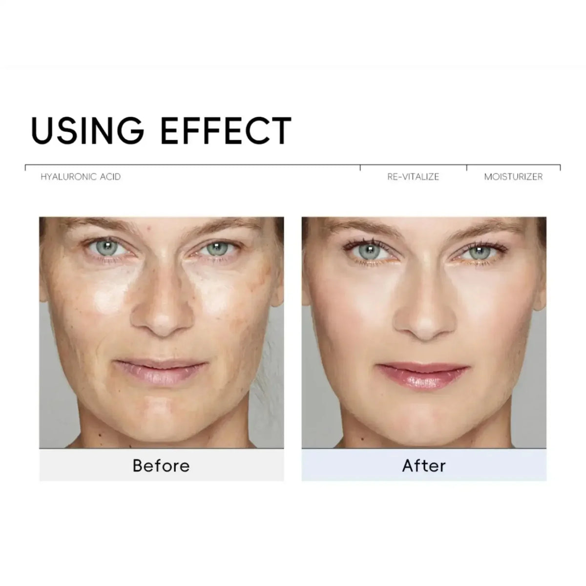 LAIKOU Hyaluronic Acid Face Cream – Hydrating & Brightening