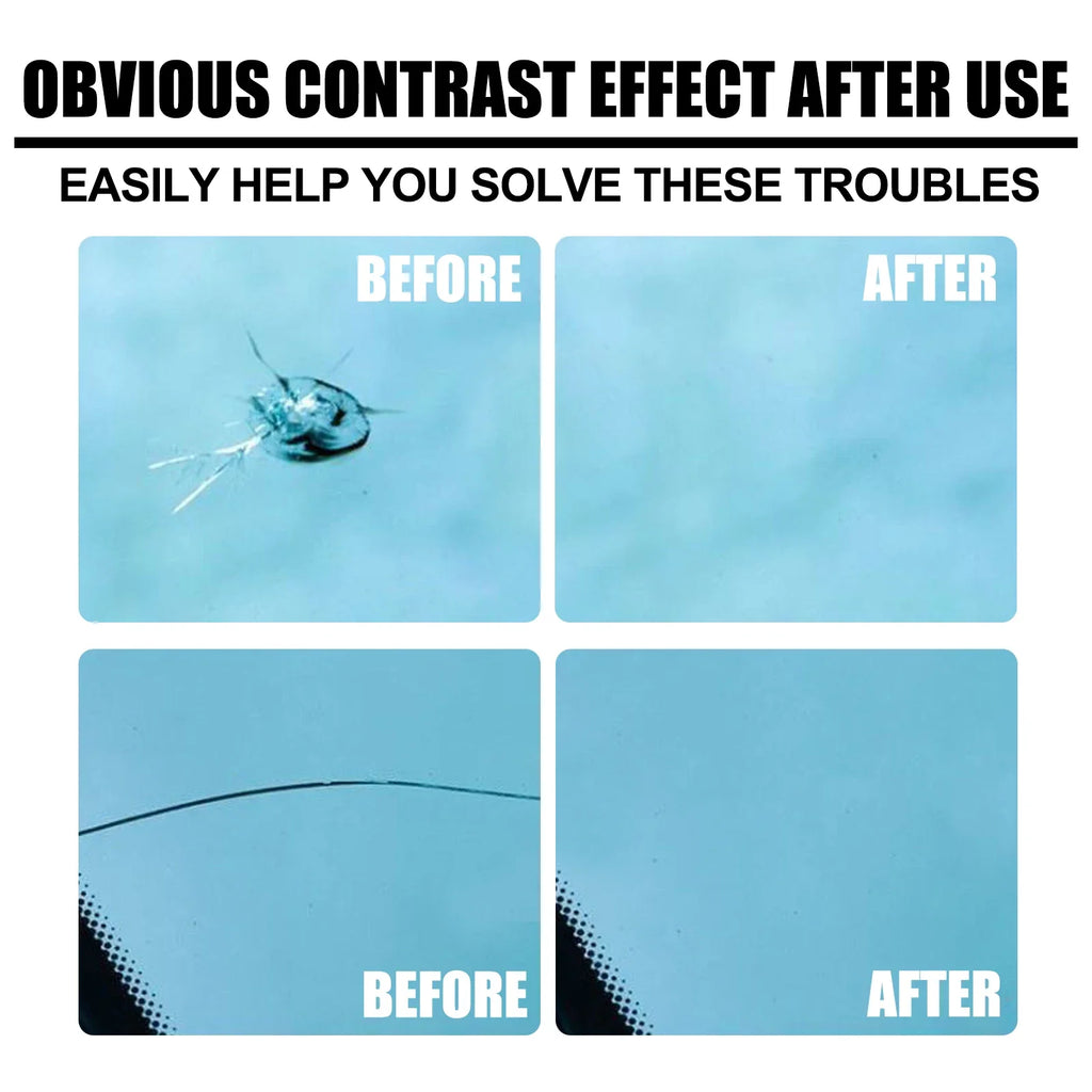 Rayhong 20ml UV Windshield Crack Repair Kit – DIY Auto Fix