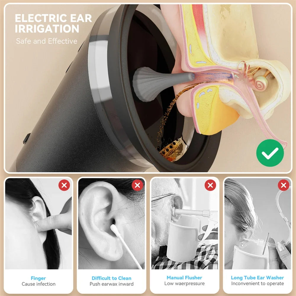 Electric Ear Wax Removal System – Water Irrigation Flusher