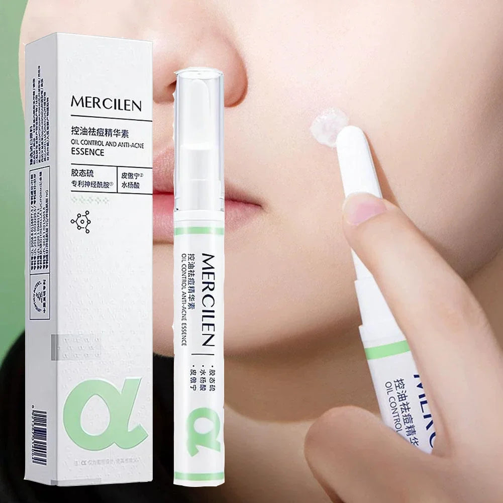 Salicylic Acid Acne Treatment Face Serum Repair Pimple Spots Deep
