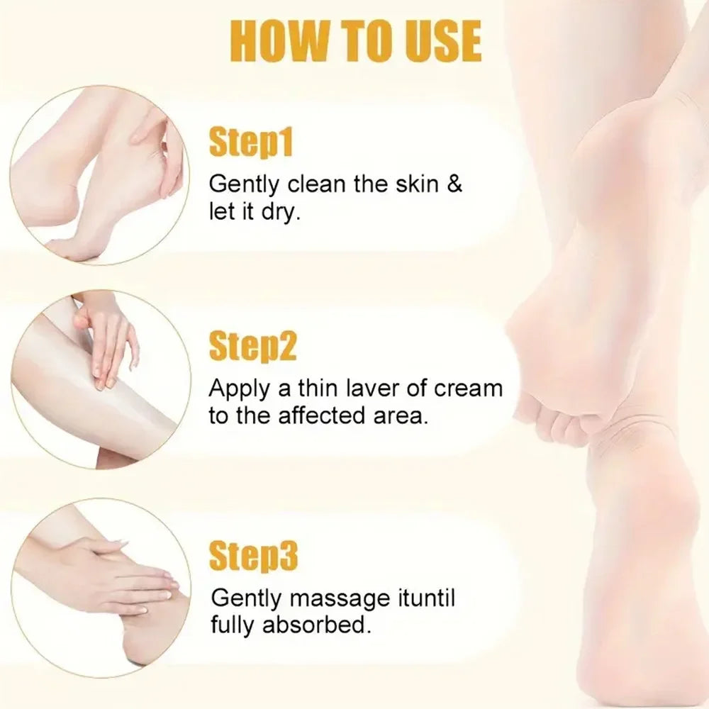 YOUNGCOME Urea Banana Balm Foot & Hand Cream – Deep Moisture