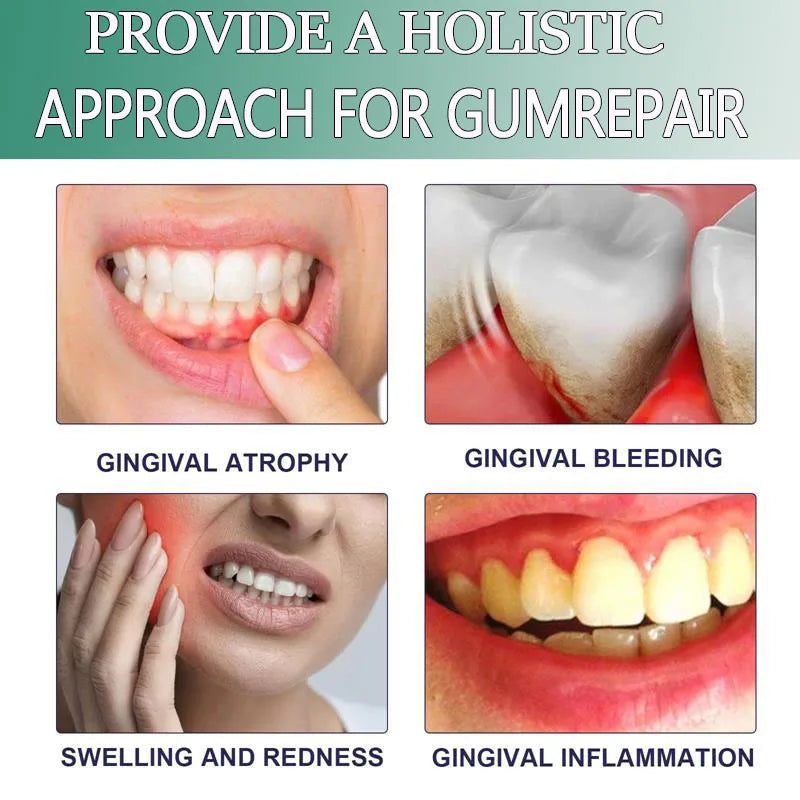 Gum Repair Gel – Plant Extract Toothpaste for Whiter Teeth
