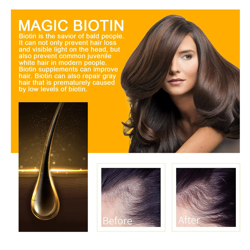 EELHOE Biotin Hair Growth Spray – Scalp Serum & Repair 30ml