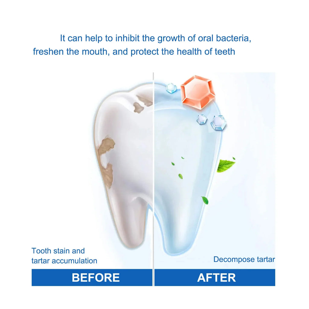 SP Probiotic Whitening Toothpaste – Fresh Breath & Gum Care