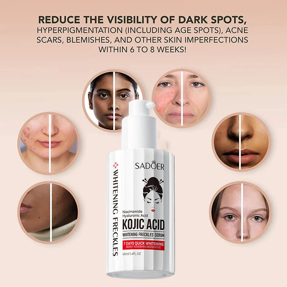 Kojic Acid Serum Strong Brightening Whitening Cream Spots Fine Lines