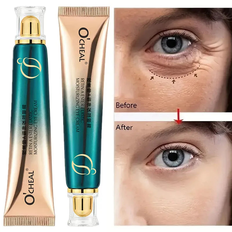 Retinol A Eye Cream – Firming, Brightening & Moisturizing 30g