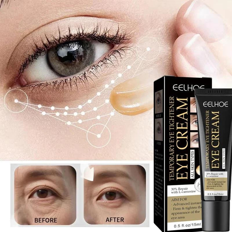 Retinol Eye Cream – Firming, Dark Circle & Hydrating 15ml