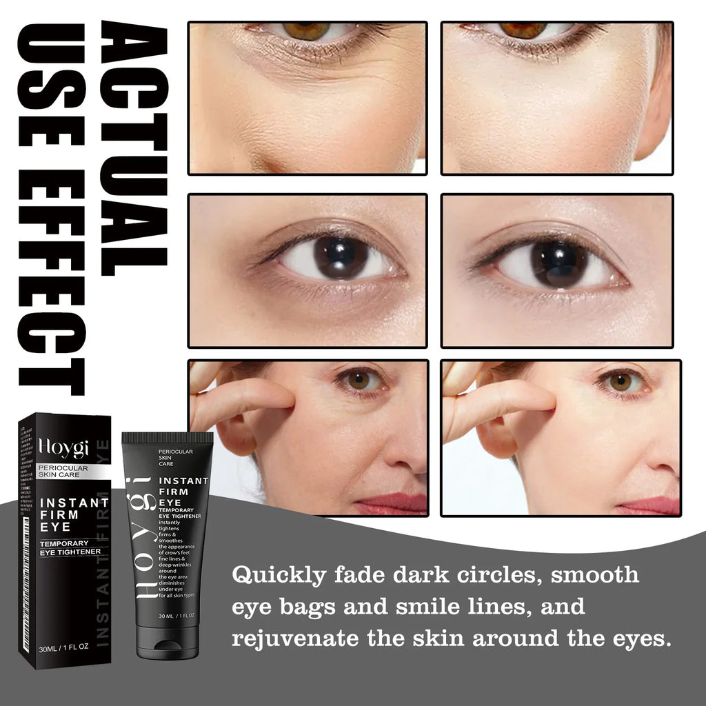 Collagen Eye Cream – Firm, Brighten & Smooth Eye Area | 30ml
