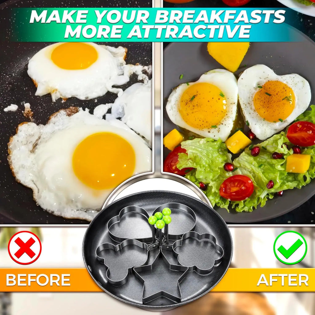 5-Piece Stainless Steel Egg & Pancake Ring Mold Set | Non-Stick