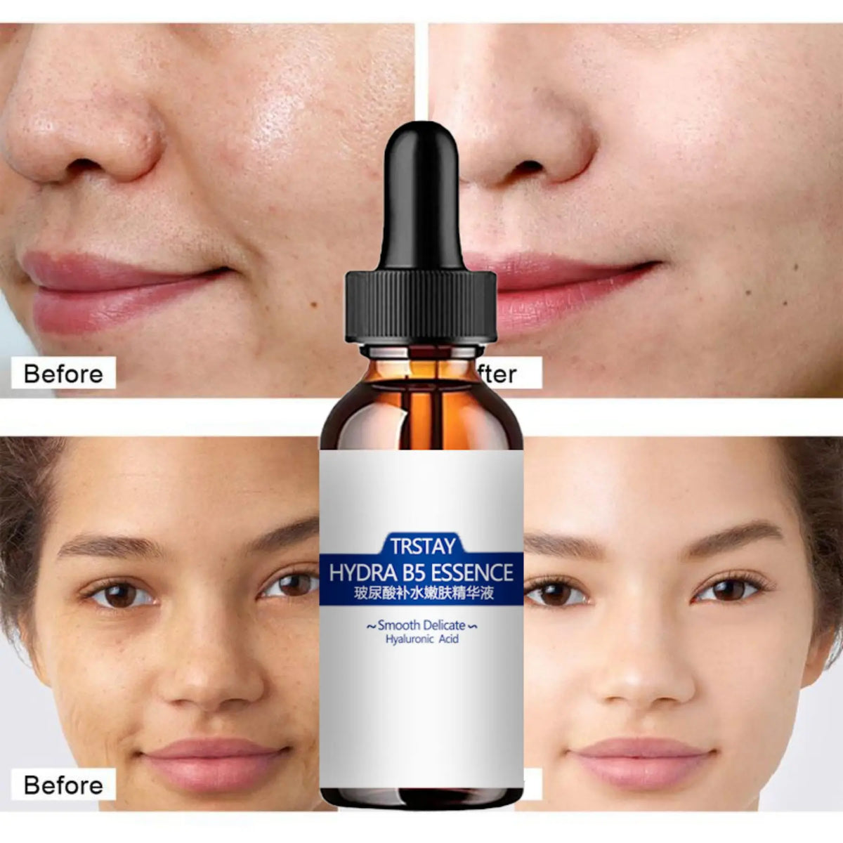 Face Serum Hyaluronic Acid Essence Moisturizing Nursing Snail Nourish